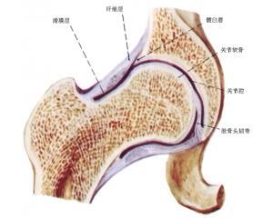 股骨头坏死常见的症状有哪些