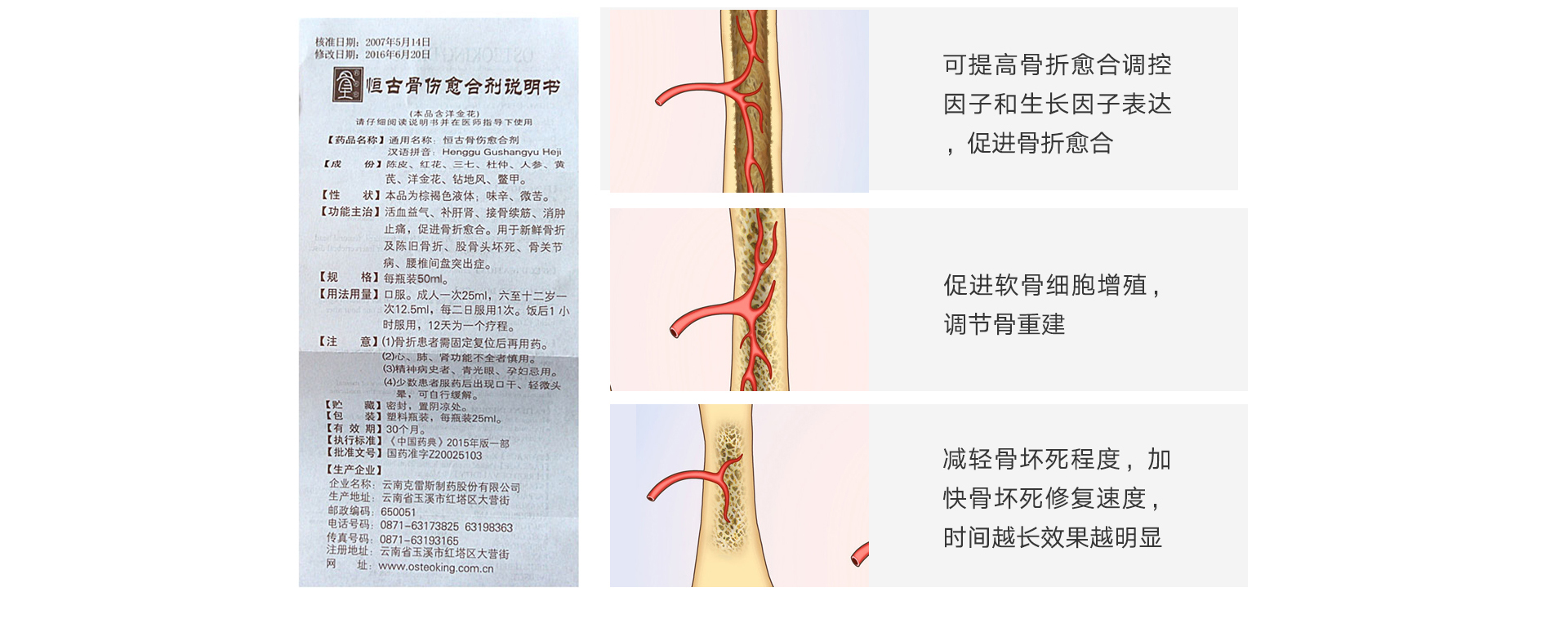 骨折